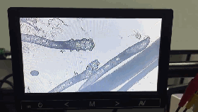 1559544760402825.gif 百度员工螨虫_clip.gif